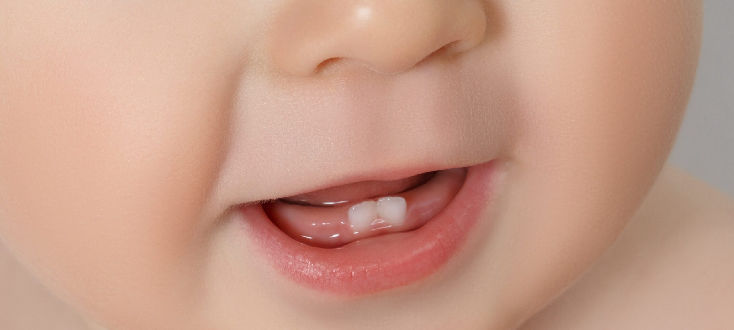 baby's front teeth- teething