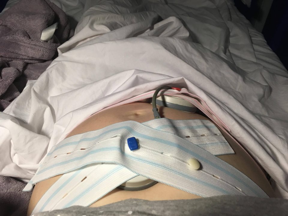 baby bump being monitored after my waters broke early