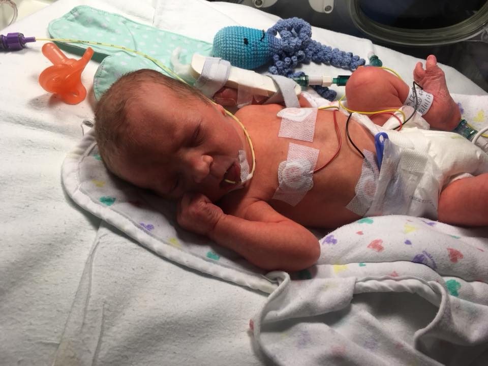 birth story- baby in NICU incubator