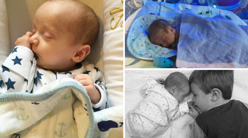 preemie parent, 3 pictures of prem baby