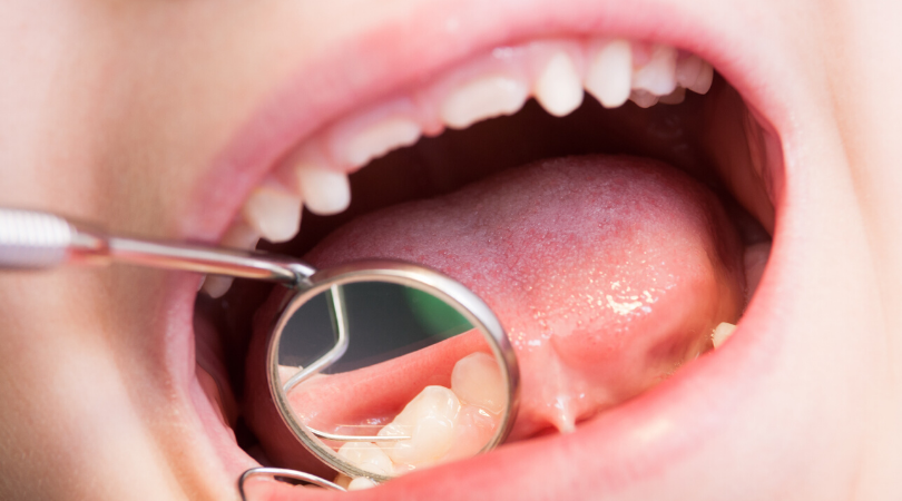 child with open mouth at the dentist