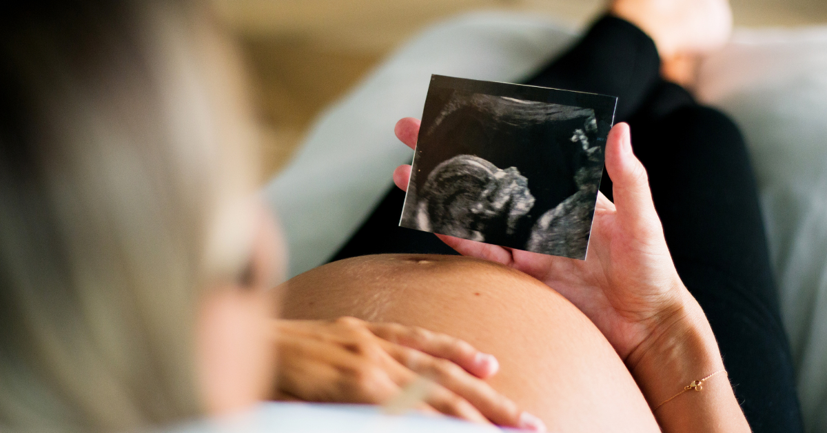 pregnant mum looking at a scan image