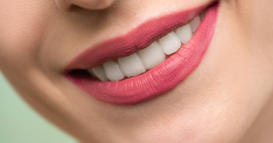 white smile