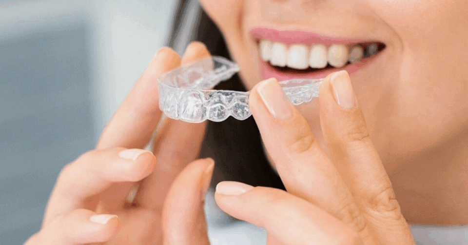 Invisalign