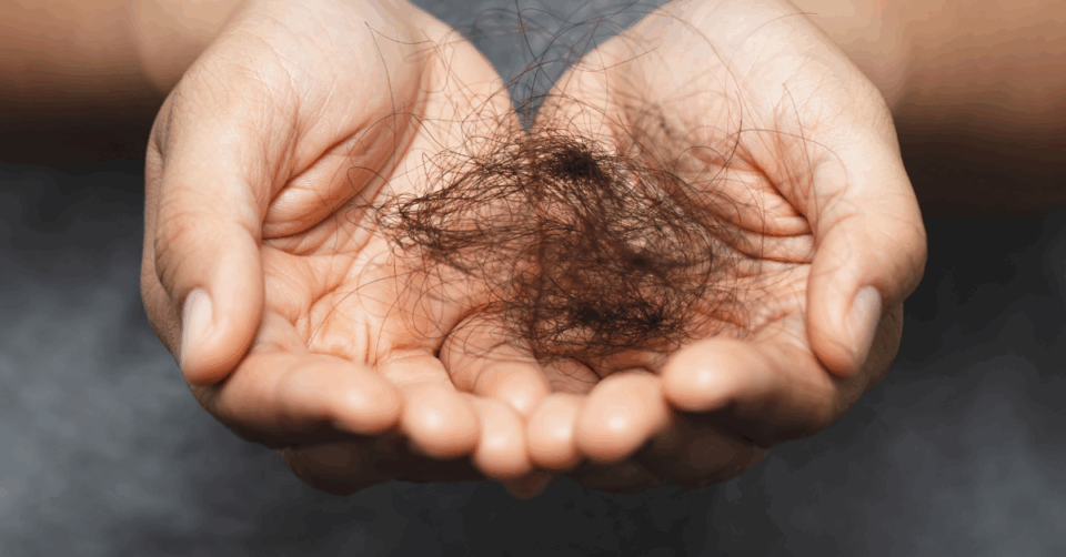 hair loss