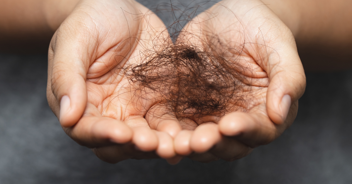 hair loss