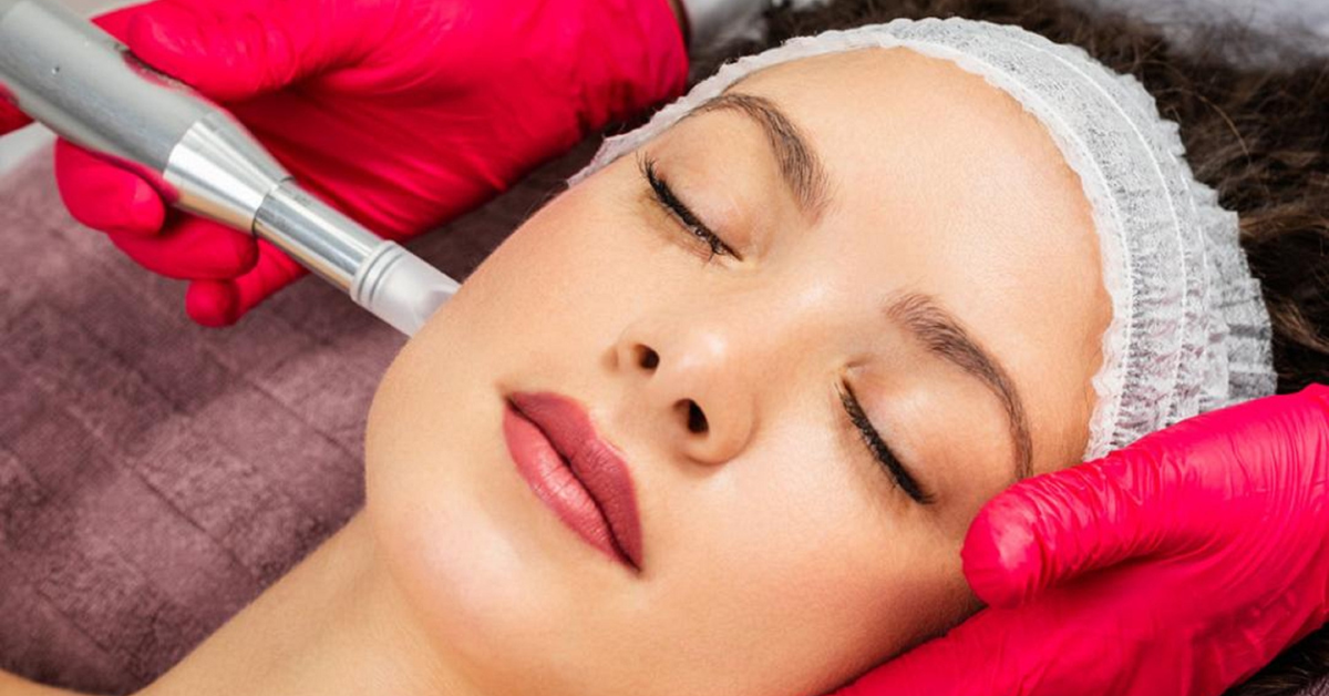 a lady getting microneedling