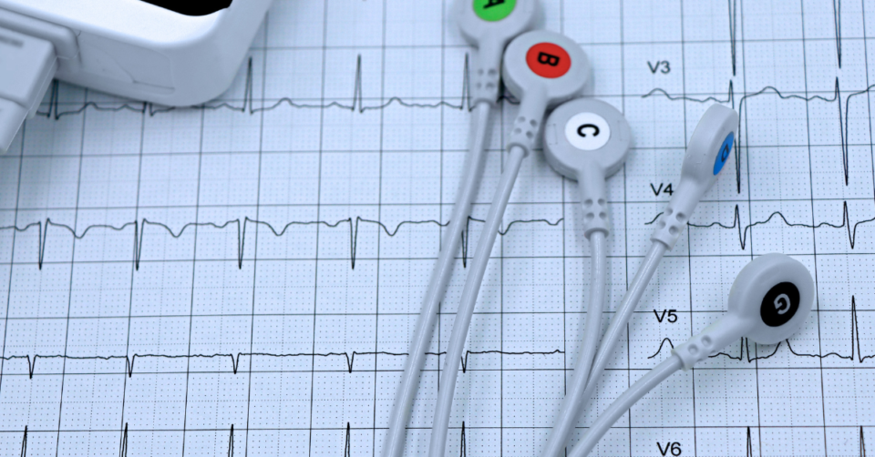 ECG