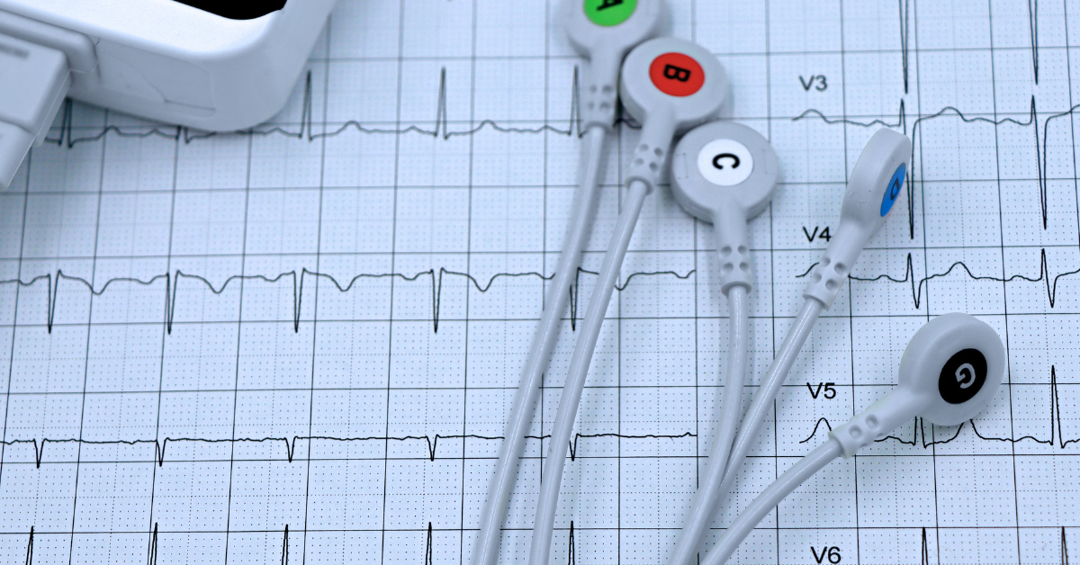 ECG