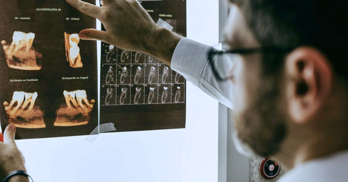 dental implants being looked at on an xray or scan by a dentist